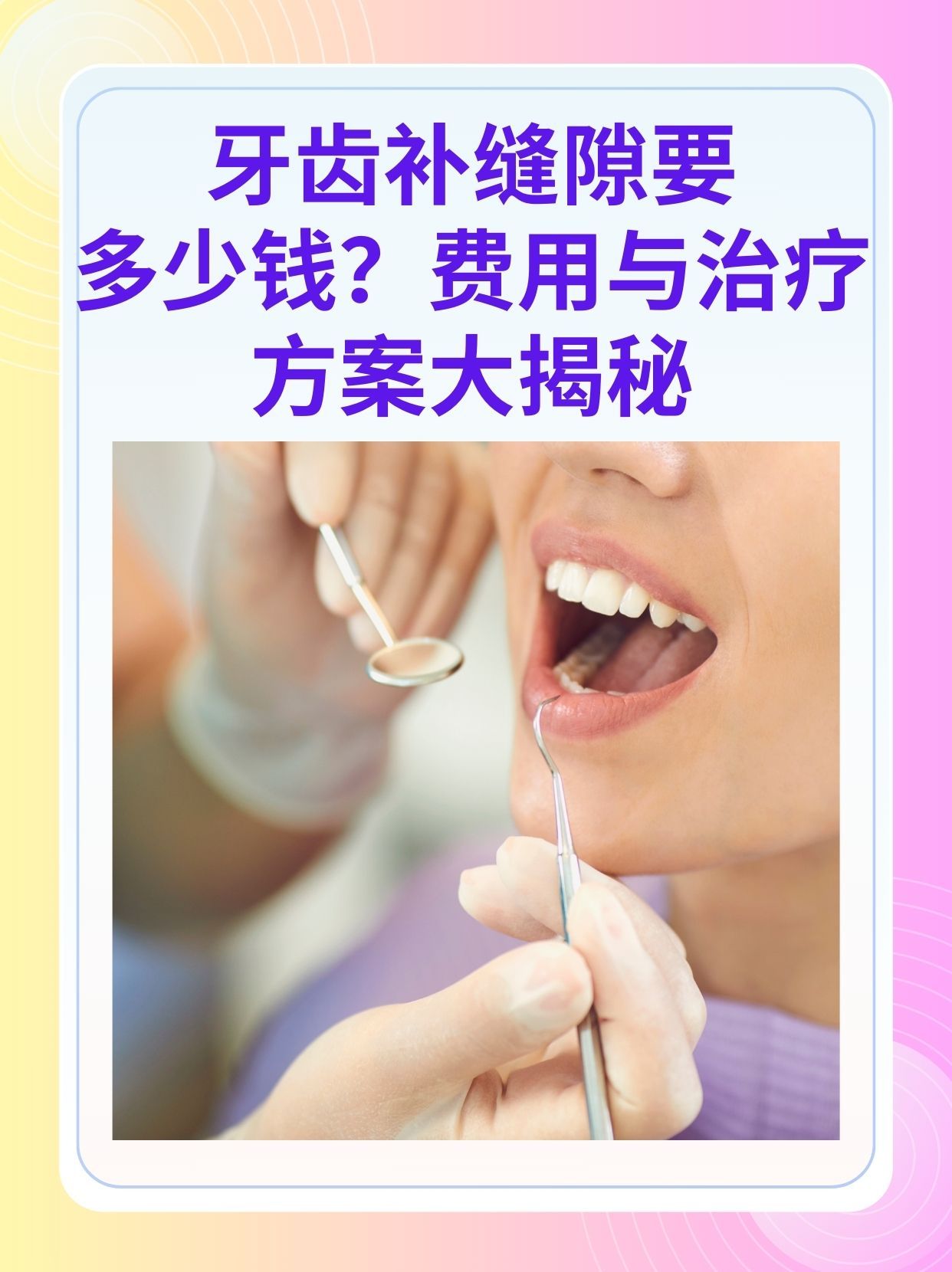 铜川补牙医保可以报销吗(补牙医保可以报销吗 哪些可以报销呢)